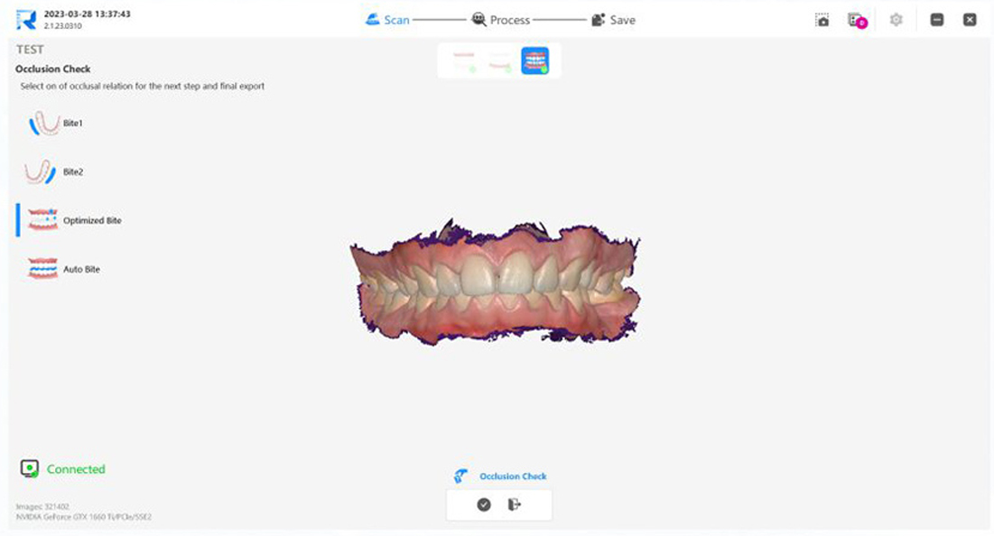 Измерение окклюзии