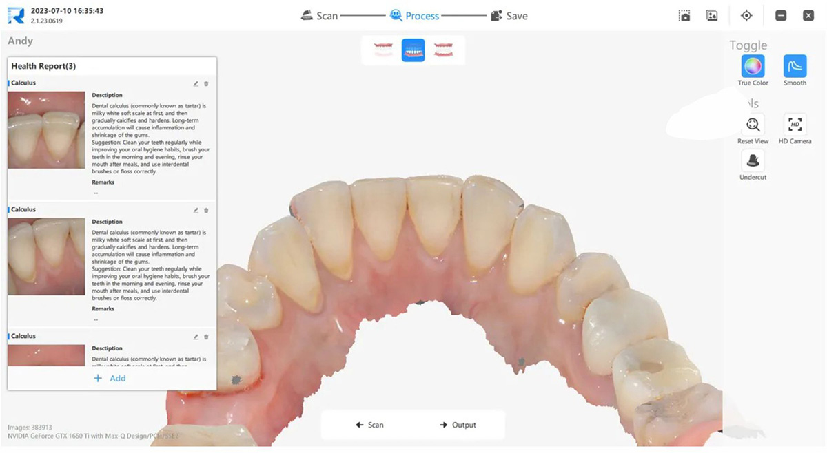 Отчет о состоянии полости рта